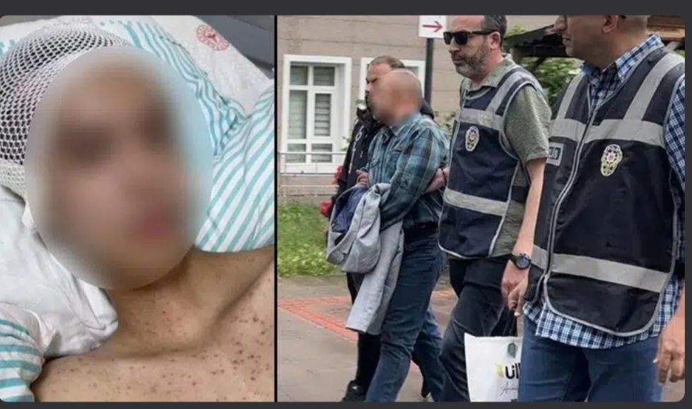 Komadan çıktı, her şeyi anlattı! Tacize direndiği iddiasıyla başından vurulan çocuk felç kaldı